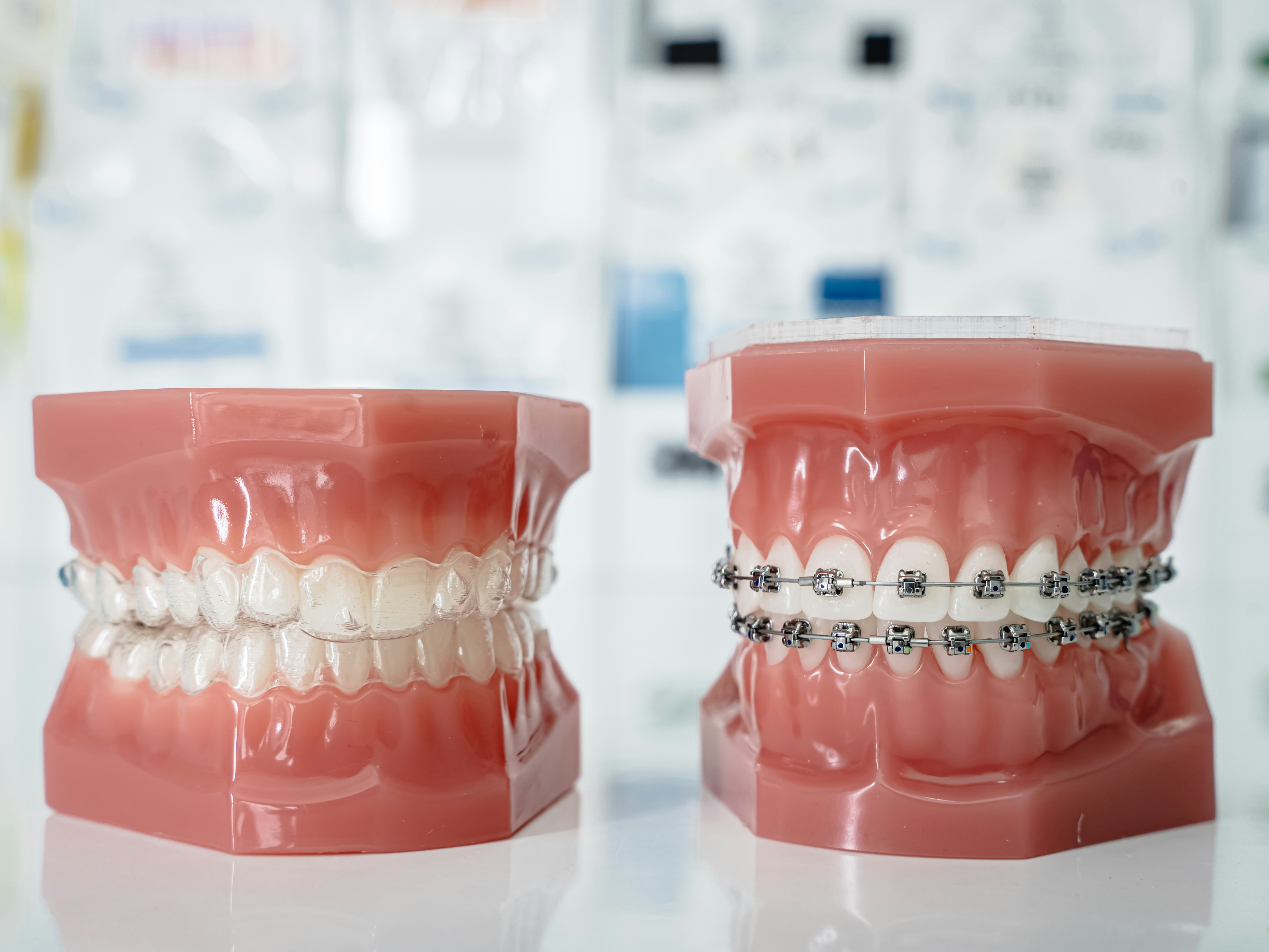 Illustration of dental braces and a clear aligner tray