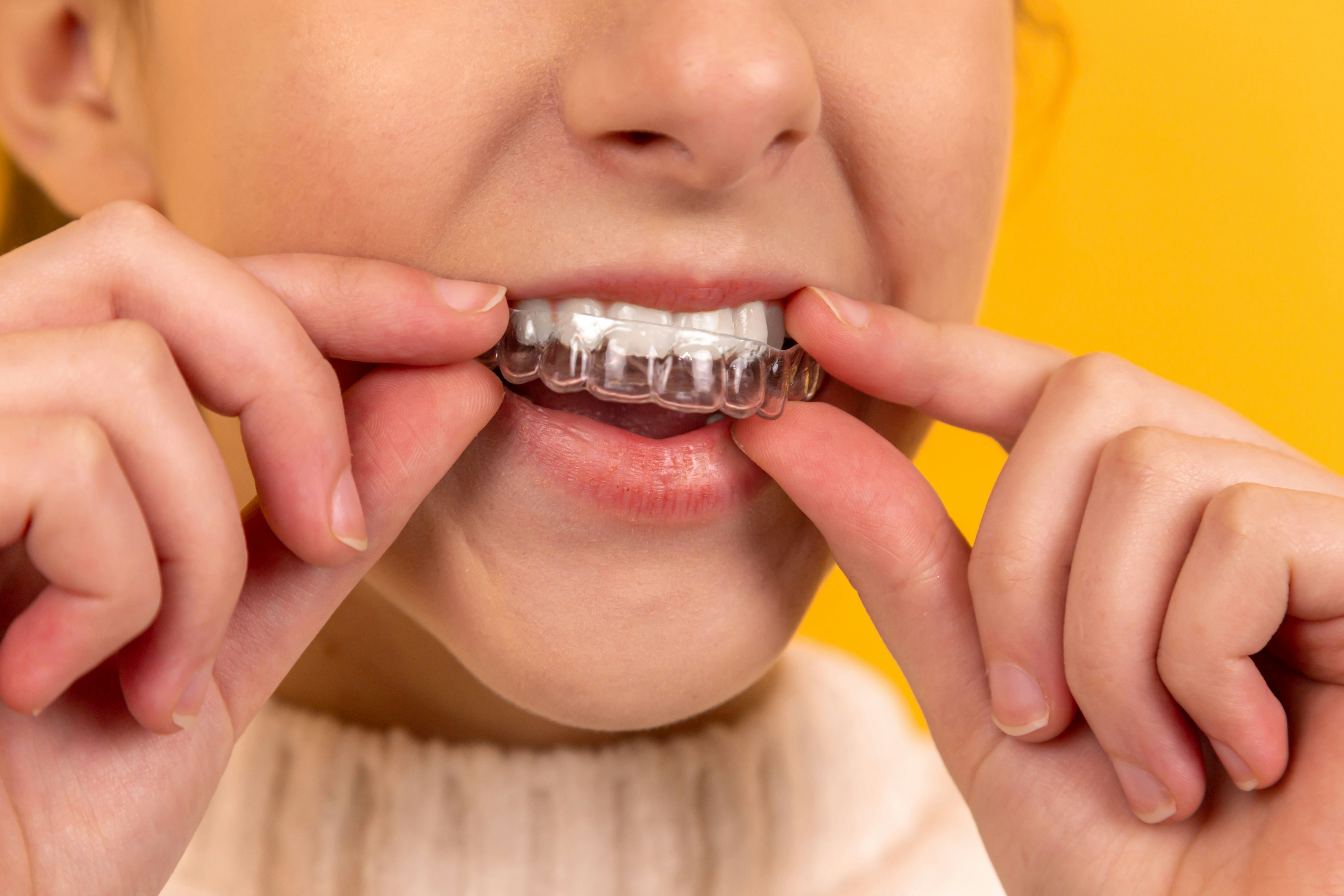 Person caring for their braces and aligners