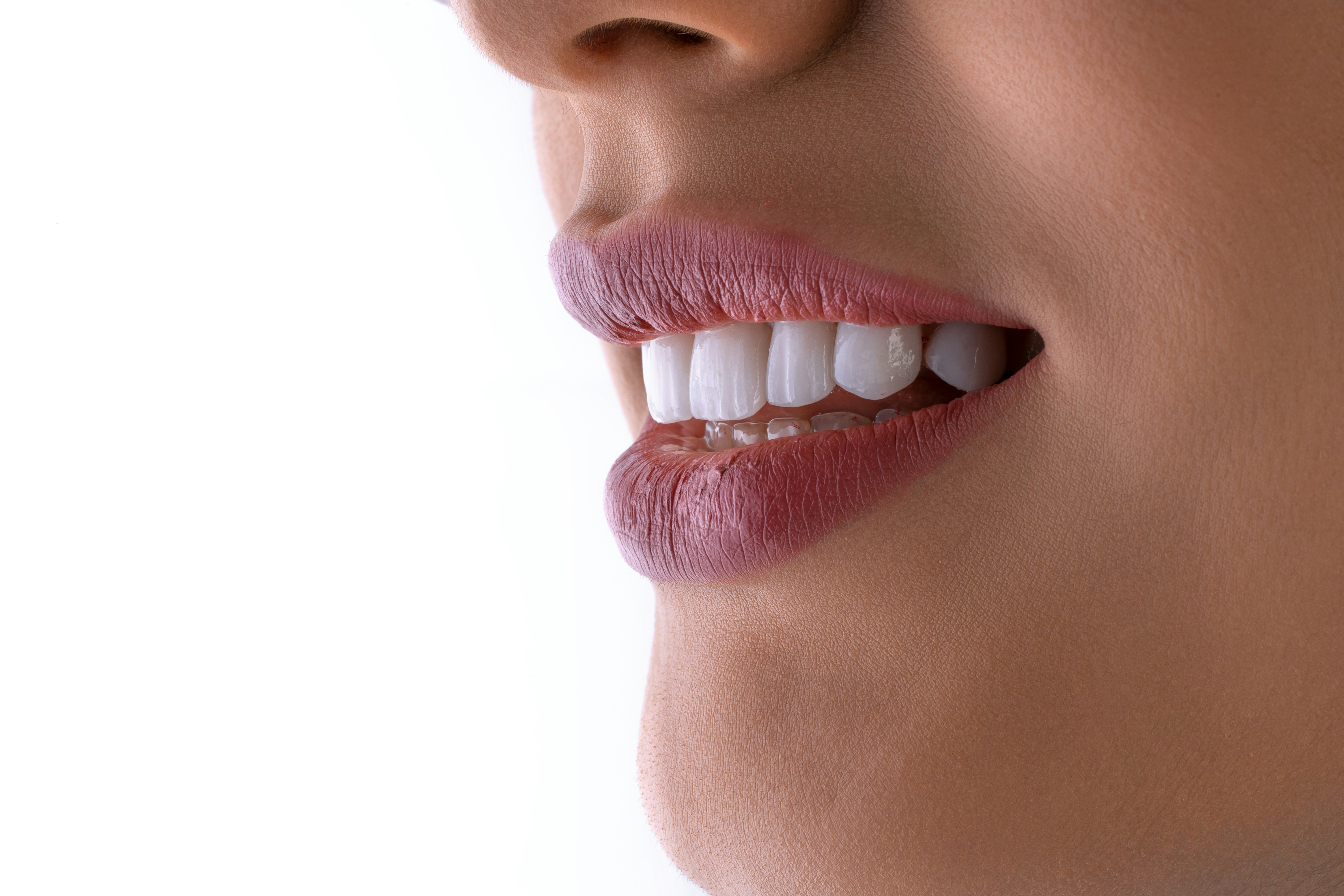 Bright white smile after professional teeth whitening